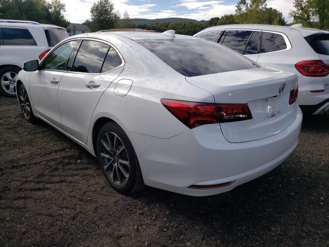 Acura TLX • 2016 • 10,000 mi 3