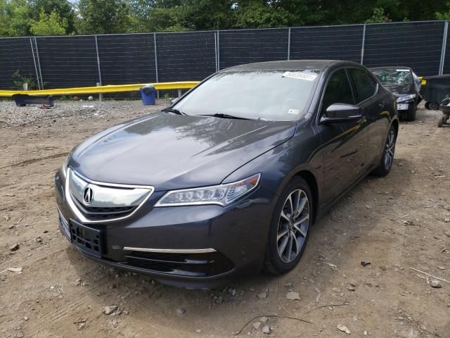 Acura TLX • 2016 • 10,000 mi 3