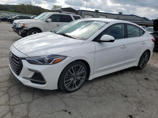 Hyundai Elantra • 2017 • 10,000 mi 3