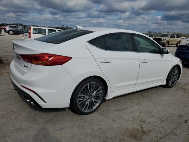 Hyundai Elantra • 2017 • 10,000 mi 6