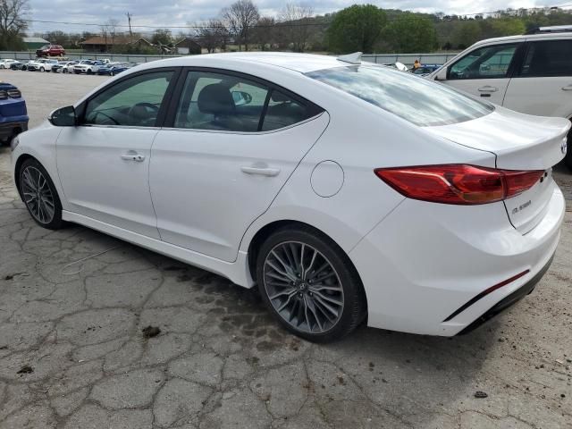 Hyundai Elantra • 2017 • 10,000 mi 4