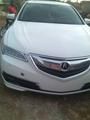 Acura TLX • 2015 • 1,000 km 5