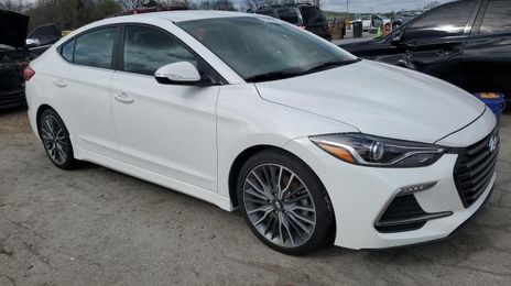 Hyundai Elantra • 2017 • 10,000 mi